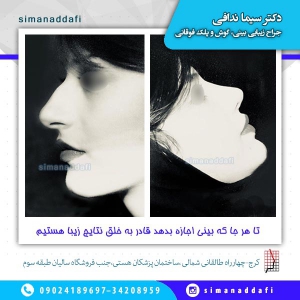 جراحی-بینی-1