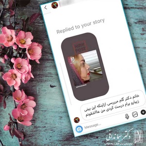 جراحی-بینی-190.jpg