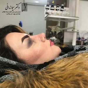 جراحی-بینی-200