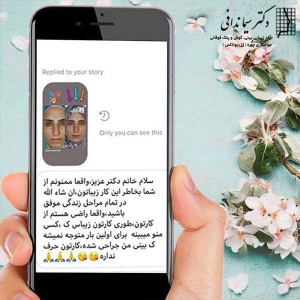 جراحی-بینی-210