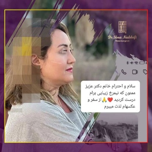 جراحی-بینی-290