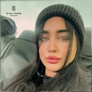 جراحی-بینی-320