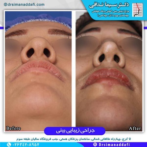 1_-بینی-کرج-3