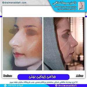 1_-بینی-137