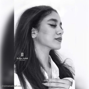 rhinoplasty-331
