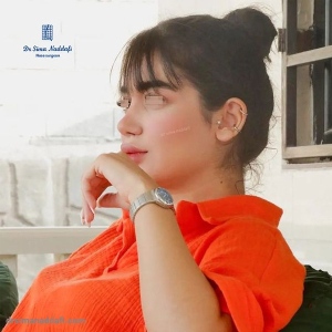 rhinoplasty-337