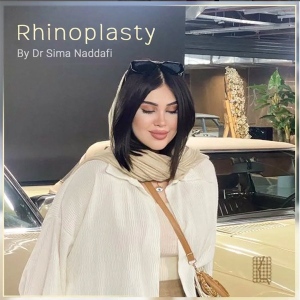 rhinoplasty-345