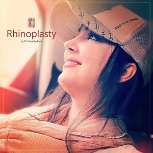 rhinoplasty-346