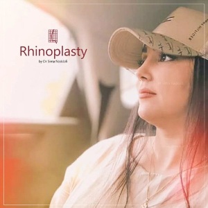 rhinoplasty-347
