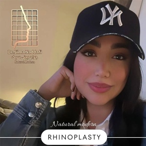 rhinoplasty-350