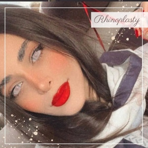rhinoplasty-357