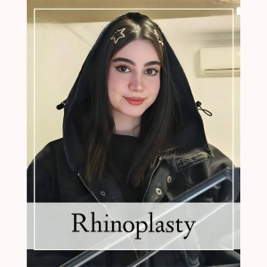 rhinoplasty-368