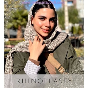 rhinoplasty-371