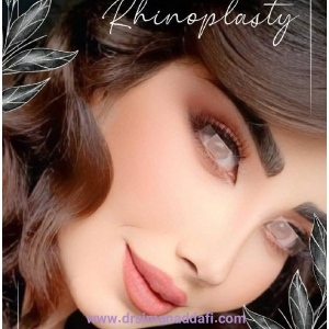 rhinoplasty-374