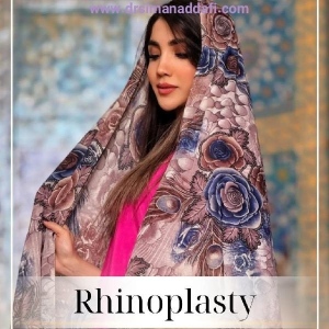 rhinoplasty-383