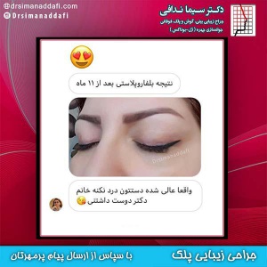 جراحی-پلک-در-کرج-7