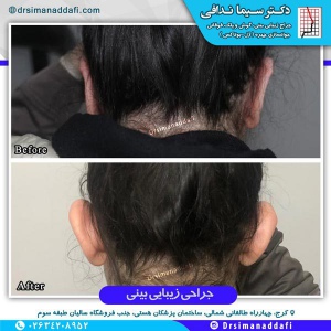 جراحی-گوش-در-کرج-1