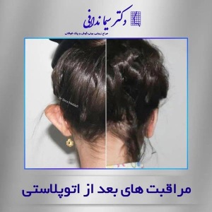 جراحی-گوش-در-کرج-12