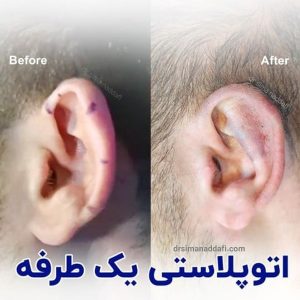 جراحی گوش در کرج - دکتر سیما ندافی