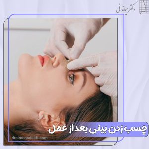 چسب زدن بینی بعد از عمل