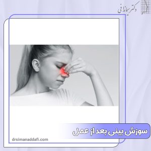 سوزش بینی بعد از عمل