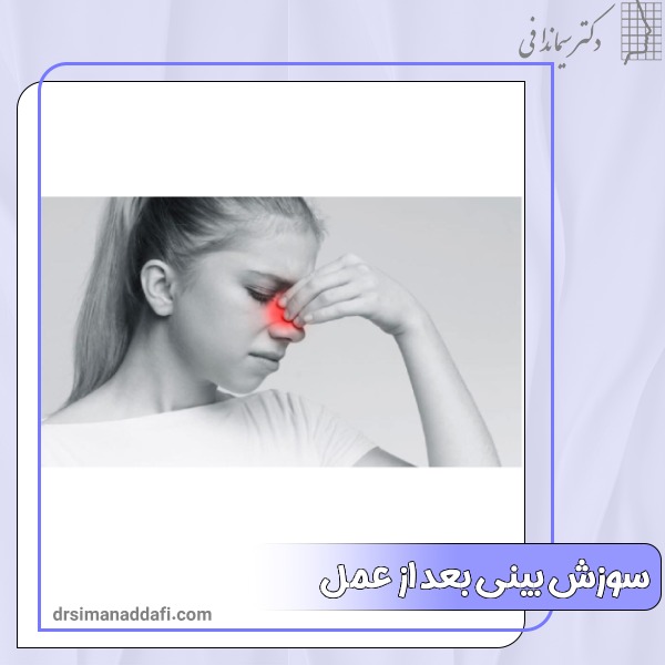 سوزش بینی بعد از عمل