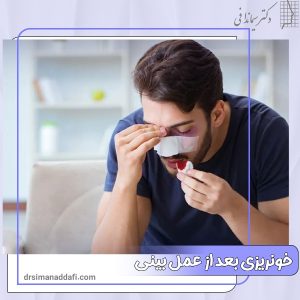 خونریزی بعد از عمل بینی