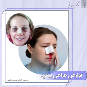 عوارض جراحی بینی