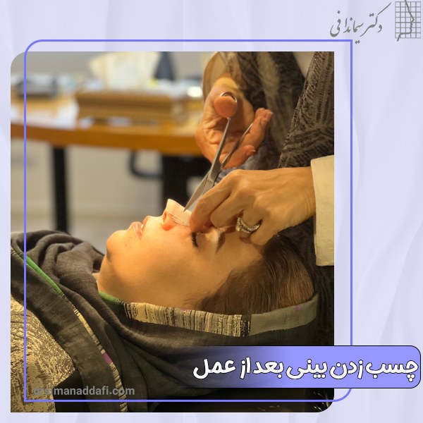 چسب زدن بینی بعد از عمل