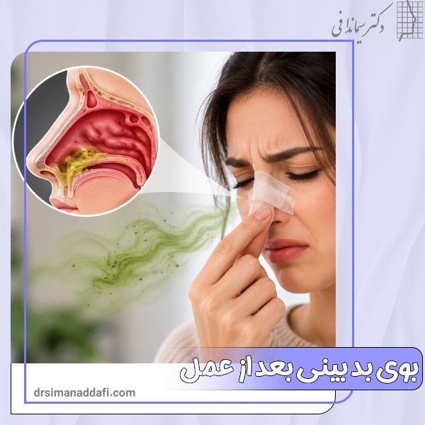 بوی بد بینی بعد از عمل