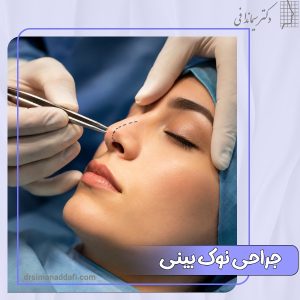 جراحی نوک بینی
